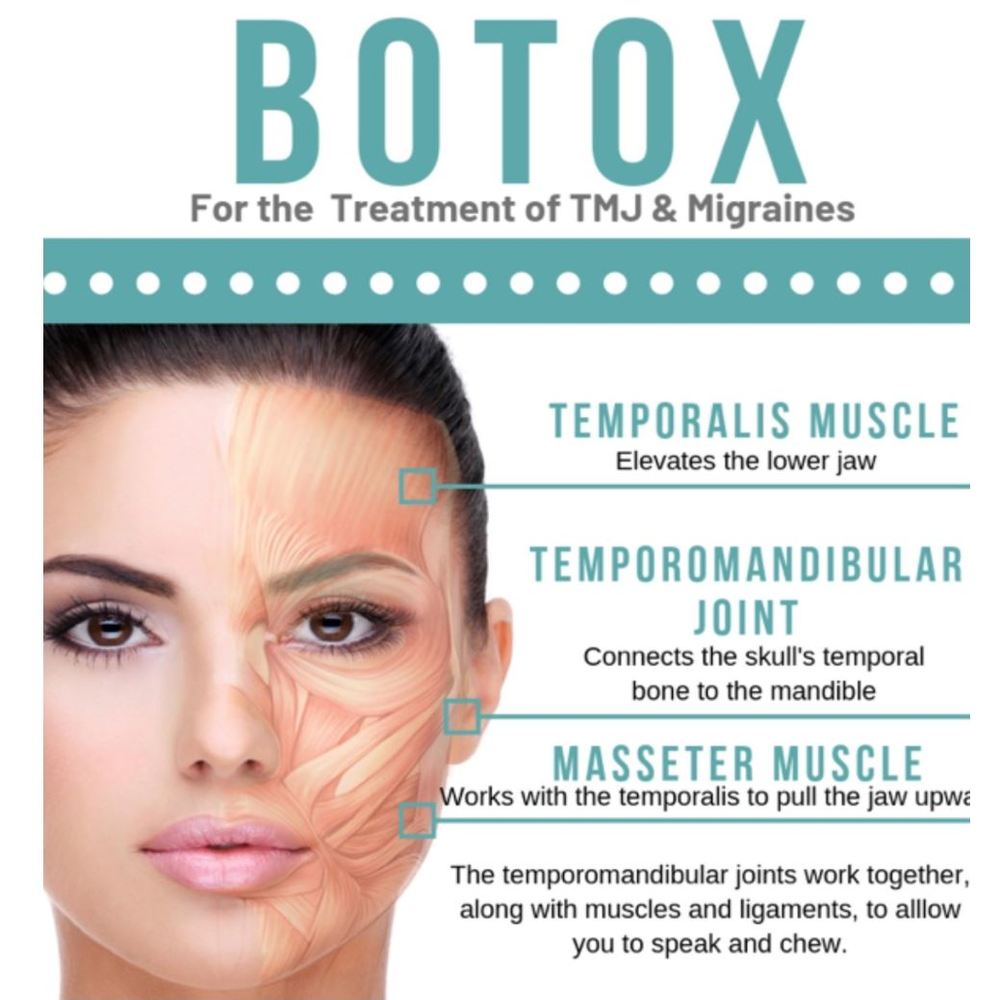 Botox Masseter – Clenching, Grinding, & Face Slimming Consultation